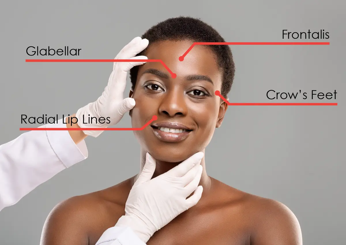 Dental Care Group facial rejuvenation