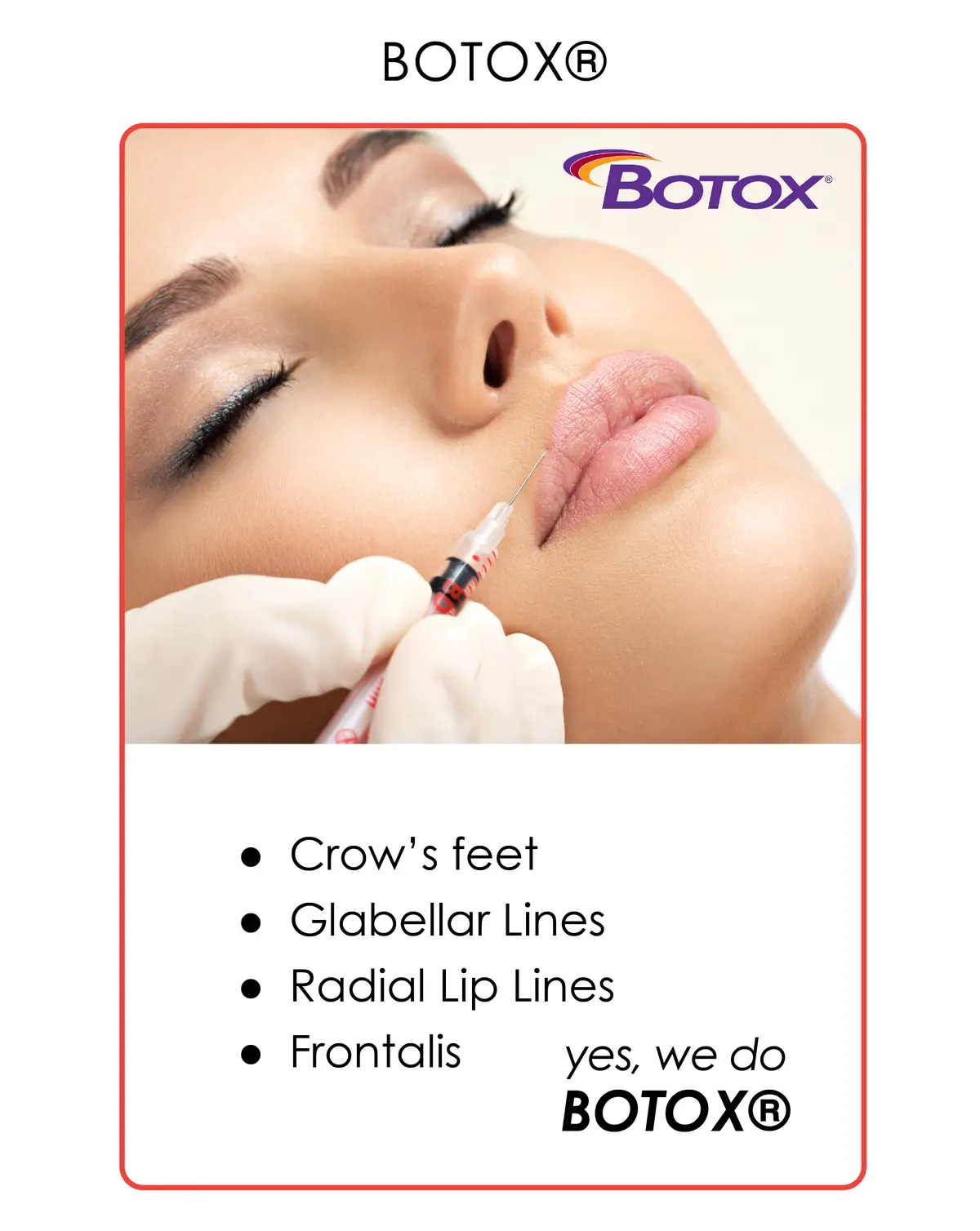 Dental Care Group botox