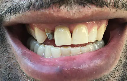 before treatment from the Dental Care Group