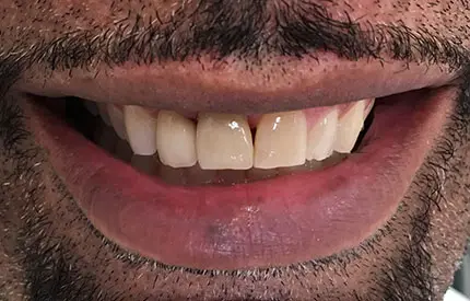after treatment from the Dental Care Group