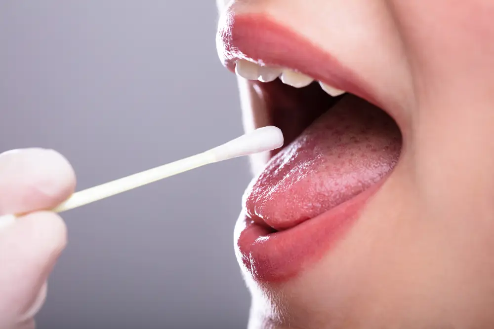 how to spot signs of oral cancer - dentist in Aventura