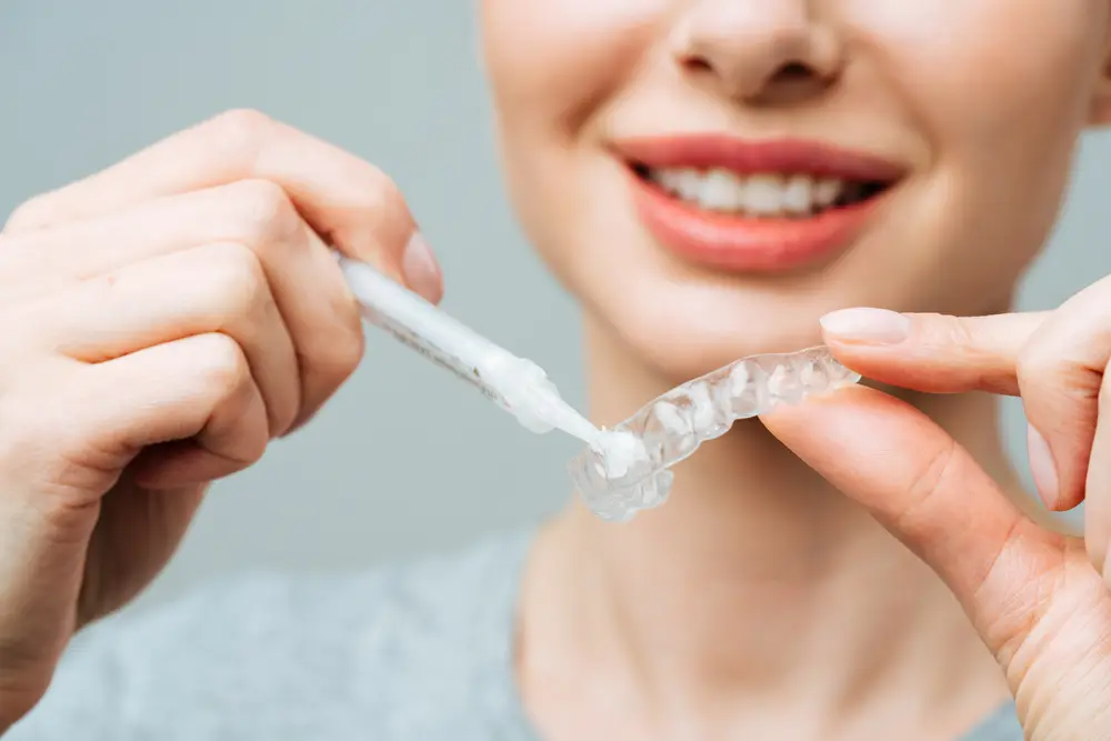 applying whitening product to tray