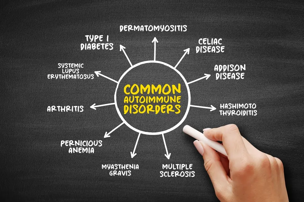 oral health in autoimmune conditions