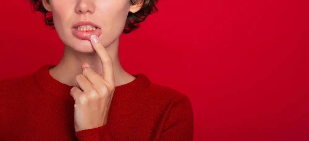 bleeding gums