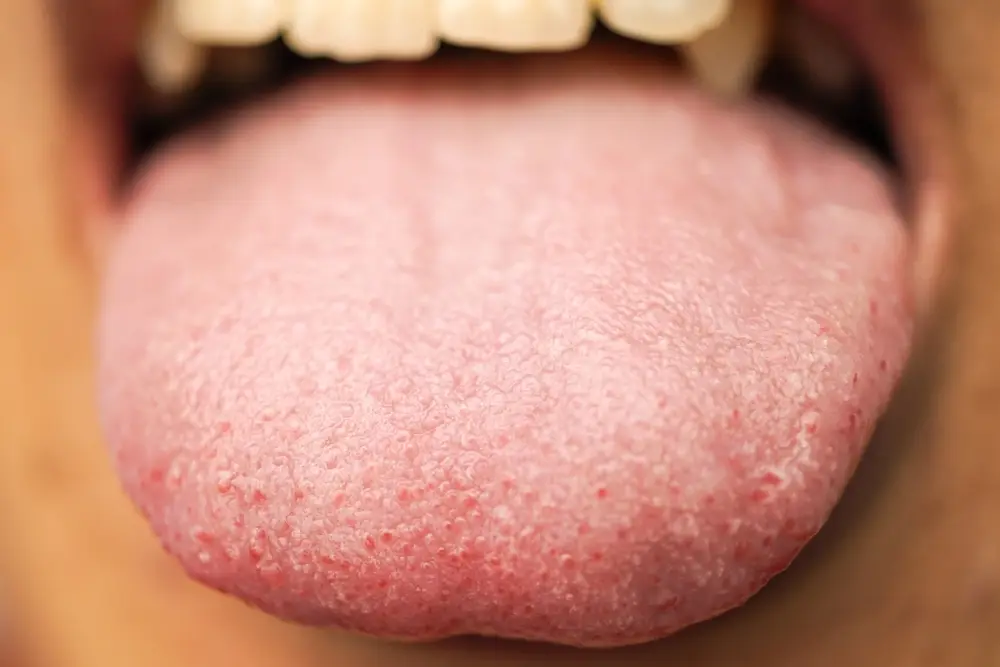 supertaster tongue
