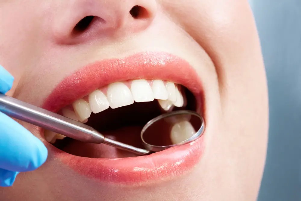 woman's mouth during dental checkup