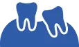 Wisdom teeth dental procedure